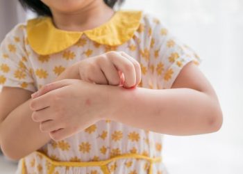 Penyakit Kulit pada Anak yang Rentan Dialami