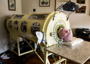 Paul Alexander Pria Paru-paru Besi Meninggal Dunia, Sosok Inspiratif Punya Tekad Kuat